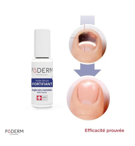 Poderm – Sérum Fortifiant Ongles du Sportif, Ongles Noirs Traumatisés 8ml