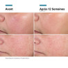 SKINCEUTICALS - Advanced RGN-6 Crème Régénérante et Réparatrice, 50ml