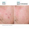 SKINCEUTICALS - Advanced RGN-6 Crème Régénérante et Réparatrice, 50ml