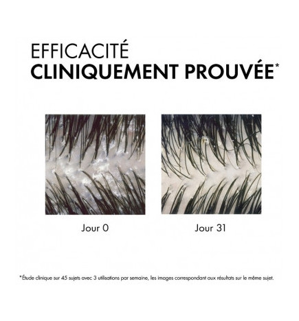 Vichy – Dercos shampoing traitant anti-pelliculaire cheveux normaux à gras, 390 ml