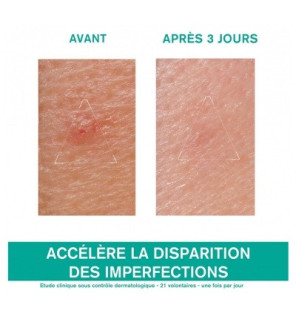 Uriage – Hyséac Pâte SOS Soin Local, 15 g