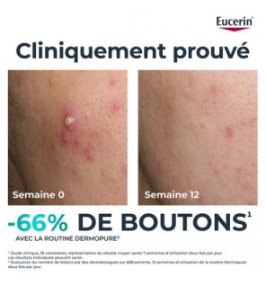 Eucerin – Dermopure Sérum Triple Action, 40 ml