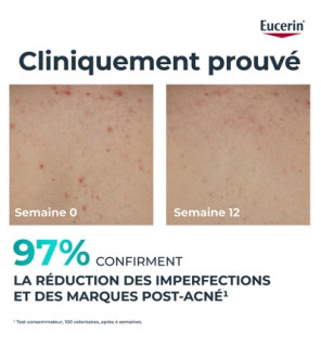 Eucerin – Dermopure Clinical Crème Corps Triple Action, 200 ml