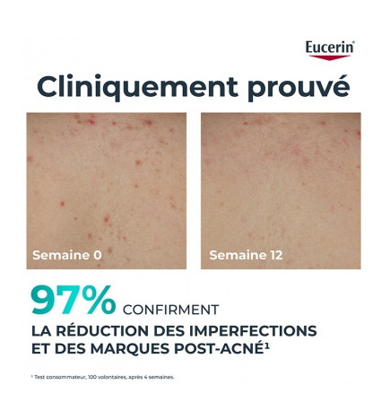 Eucerin – Dermopure Clinical Crème Corps Triple Action, 200 ml