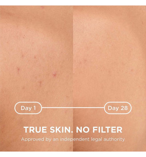 Bioderma – Sébium Kerato+ Body Soin anti-imperfections spray, 150 ml