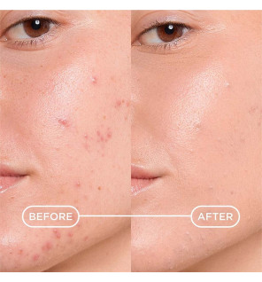 Bioderma – Sébium Kerato+ Cover Soin teinté anti-imperfections, 30 ml