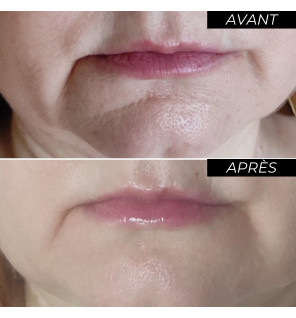 Codexial – Enotime Complexe Global Crème visage anti-rides tri-peptide tenseur, 50 ml