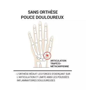 Epitact – Orthèse de pouce nuit thermoformable rigide main gauche taille M, 1 unité