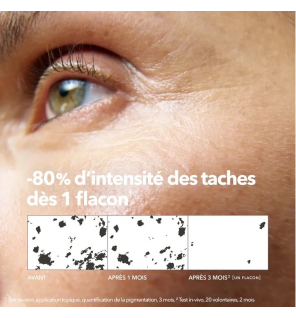 Krème – Sérum concentré anti-taches visage peaux sensibles, 30 ml