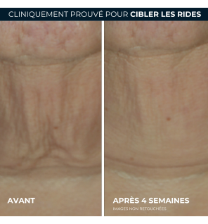 RoC – Derm Correxion Sérum Raffermissant au Rétinol, 30 g