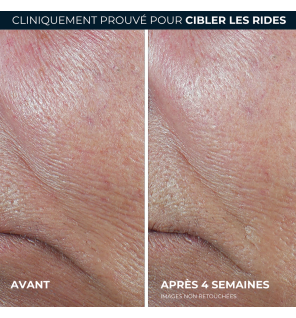 RoC – Derm Correxion Sérum Raffermissant au Rétinol, 30 g