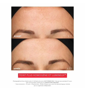 Eneomey – Light Renew Gel Dépigmentant Anti-Âge, 20 ml