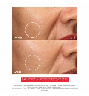 Eneomey – Light Renew Gel Dépigmentant Anti-Âge, 20 ml