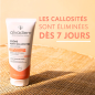 Alvadiem – Crème anti-callosités, 75 ml Alvadiem – Crème anti-callosités, 75 ml