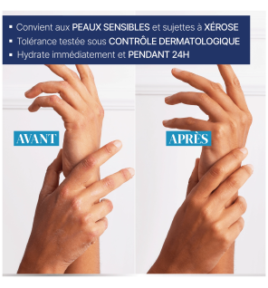 Urgo – Crème réparation intense mains abîmées, 50 ml