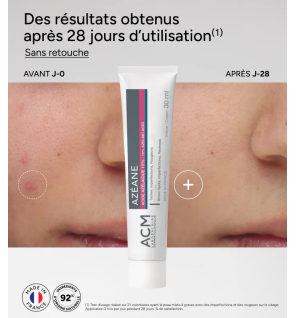 Azéane – Crème acide azélaïque 15 %, 30 ml