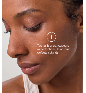 Azéane – Crème acide azélaïque 15 %, 30 ml