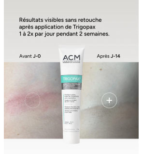 Trigopax – Soin protecteur et apaisant, 75 ml
