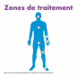Excilor – ZéroVerrue Freeze Excel traitement des verrues, 14,3 g