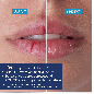 Urgo – Filmogel Baume Fissures Lèvres, 3 ml
