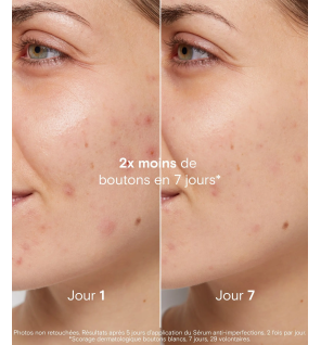 La Rosée – Coffret anti-imperfections, 3 produits