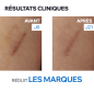 Uriage – Bariéderm Cica+ Crème réparatrice, 40 ml Uriage – Bariéderm Cica+ Crème réparatrice, 40 ml