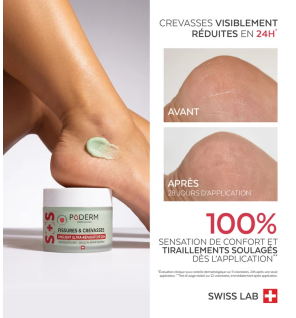 Poderm – Onguent Ultra-Réparateur Fissures & Crevasses, 25 g