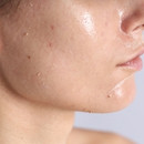 Soins pour peau sensible