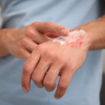 Pommades (cicactrisante, brûlures...)