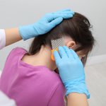 Soins Anti-Poux